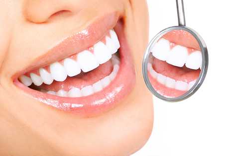 Dán sứ Veneer và bọc răng sứ khác nhau thế nào?