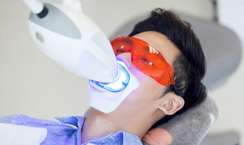 Các phương pháp cải thiện màu răng
